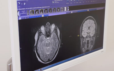 Private Consultant for Multiple Sclerosis (MS)