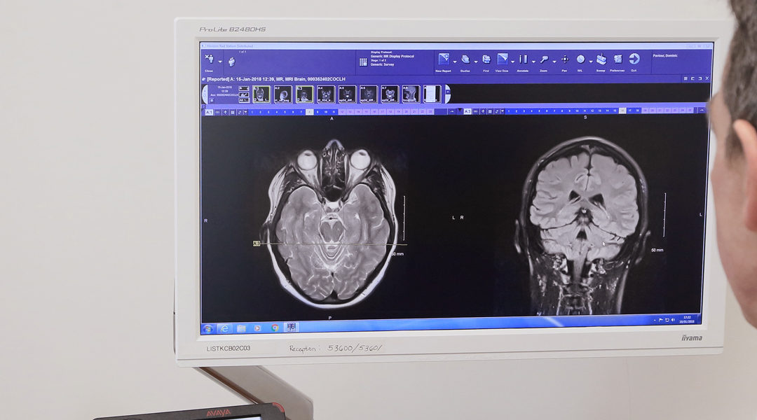 Finding a neurologist to help with Parkinson’s Disease