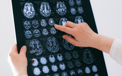 Consultant Neurologist London