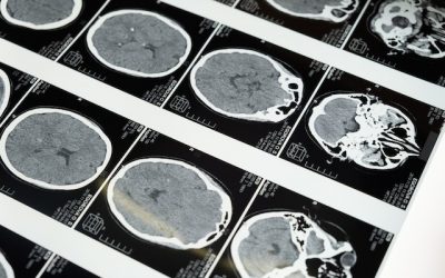 Consultant Neurologist London